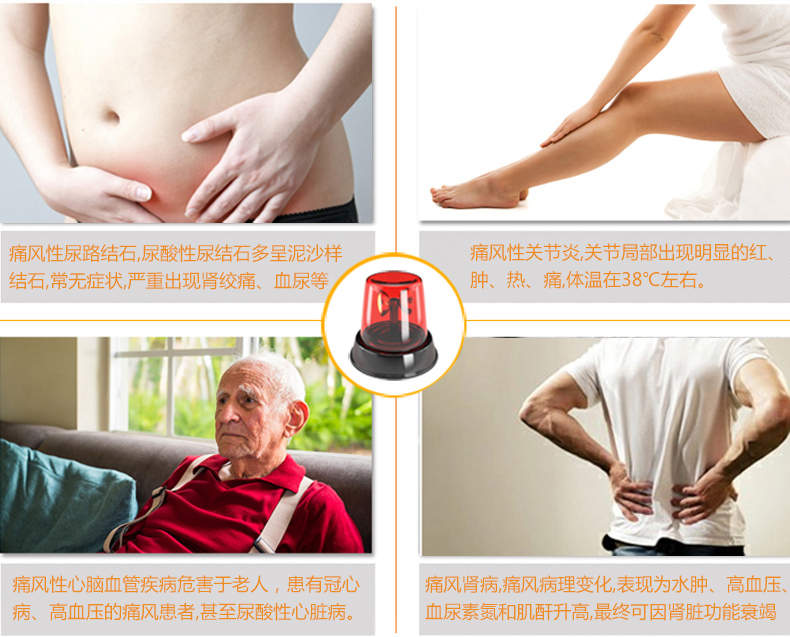 优速型血糖尿酸测试仪家用测尿酸 尿酸仪