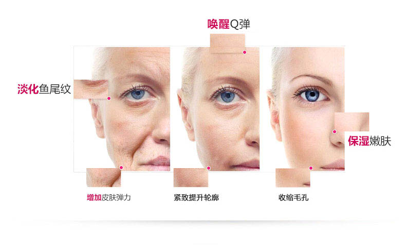 日本娜蜜丝导入美容仪器家用 脸部射频嫩肤仪童颜机nanoSkin-L