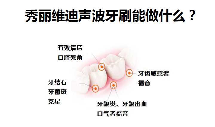 秀丽维迪声波牙刷（感应式/干电池）成人声波牙刷、儿童声波牙刷